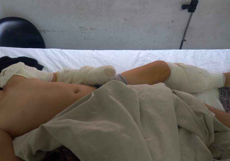  El menor permanece internado en Mar del Plata tras recibir graves heridas. La causa tramita en la Fiscalía de Delitos Culposos.