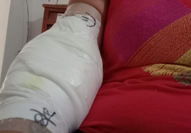 La Fiscalía 11 imputó al propietario del animal y la víctima recibió asistencia médica en el CAPS.