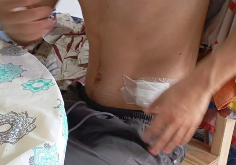 Recibió atención médica en el centro de salud de Santa Clara y se encuentra fuera de peligro. El mismo animal habría lesionado a otras personas en la zona.